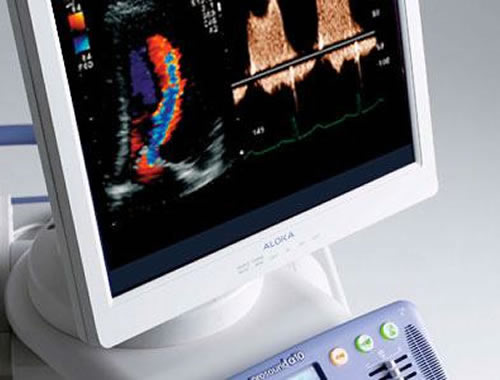 Elettrocardiogramma e doppler