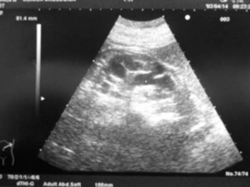 Linfoma Renale Gatto Veterinario Online Notizie Veterinarie